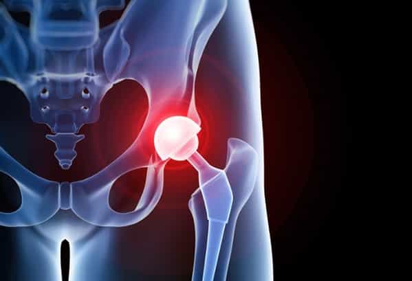 check the post:How Technology Changed Joint Replacement Surgery for a description of the image 